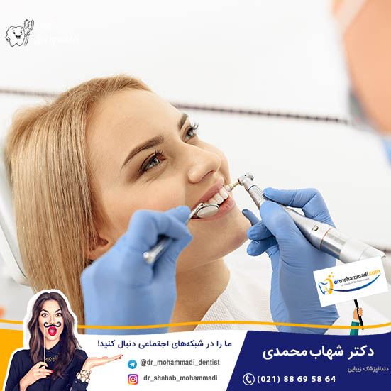 ویژگی های دکتر خوب برای بلیچینگ - کلینیک دندانپزشکی دکتر شهاب محمدی